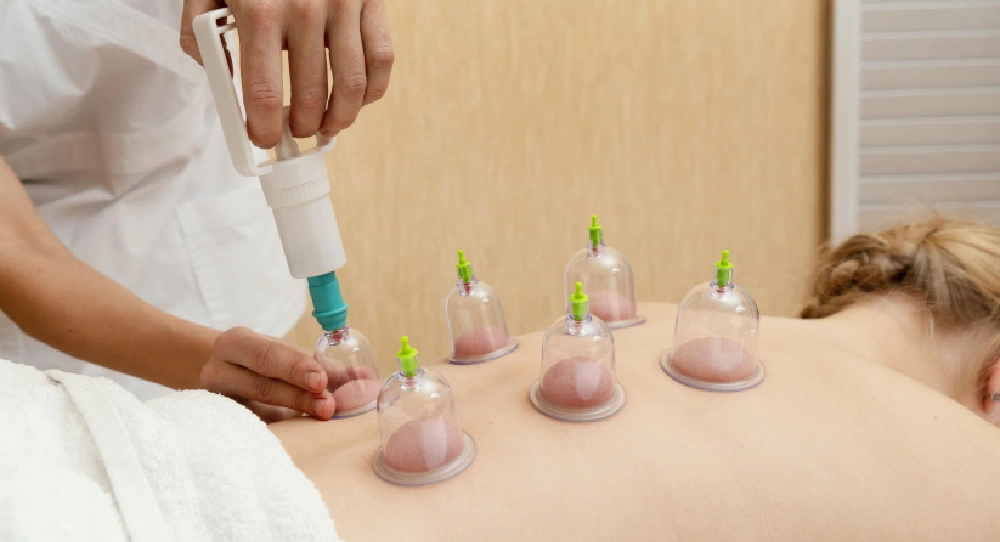 Cupping therapy benefits